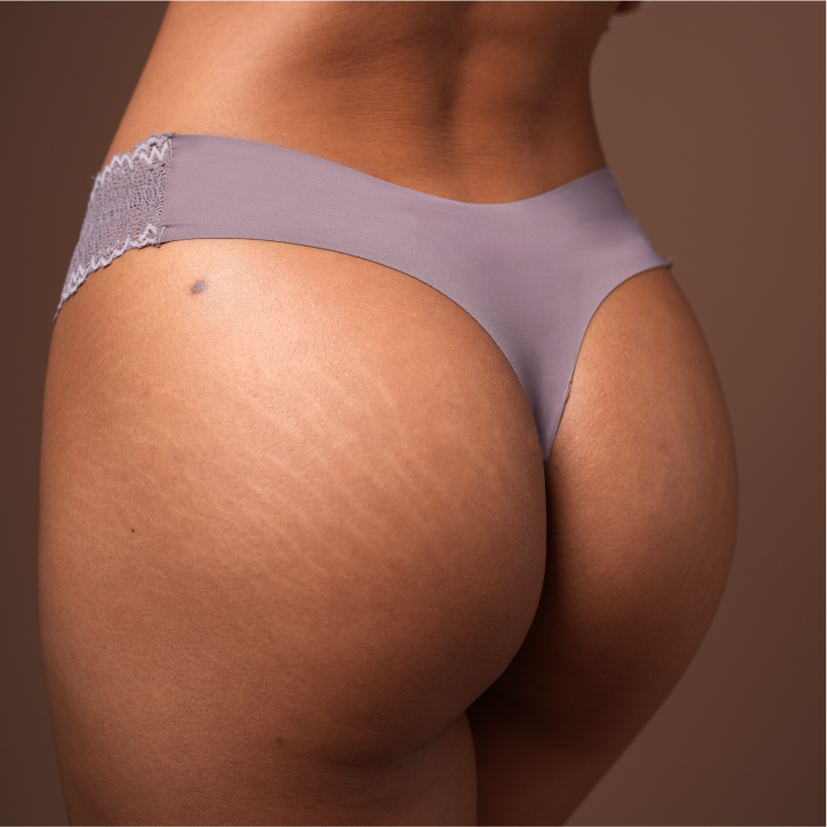 Aster Thong - 6 Colors